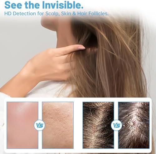 Wireless Digital Skin and Scalp Camera — photo 3